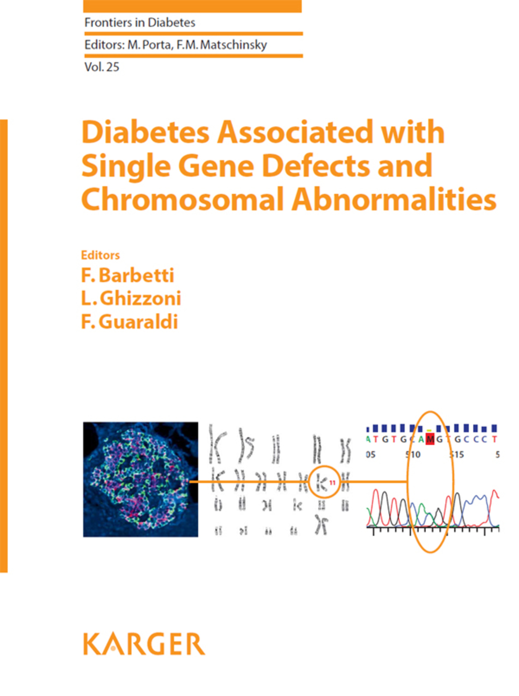 Diabetes Associated with Single Gene Defects and Chromosomal Abnormalities 1st Edition