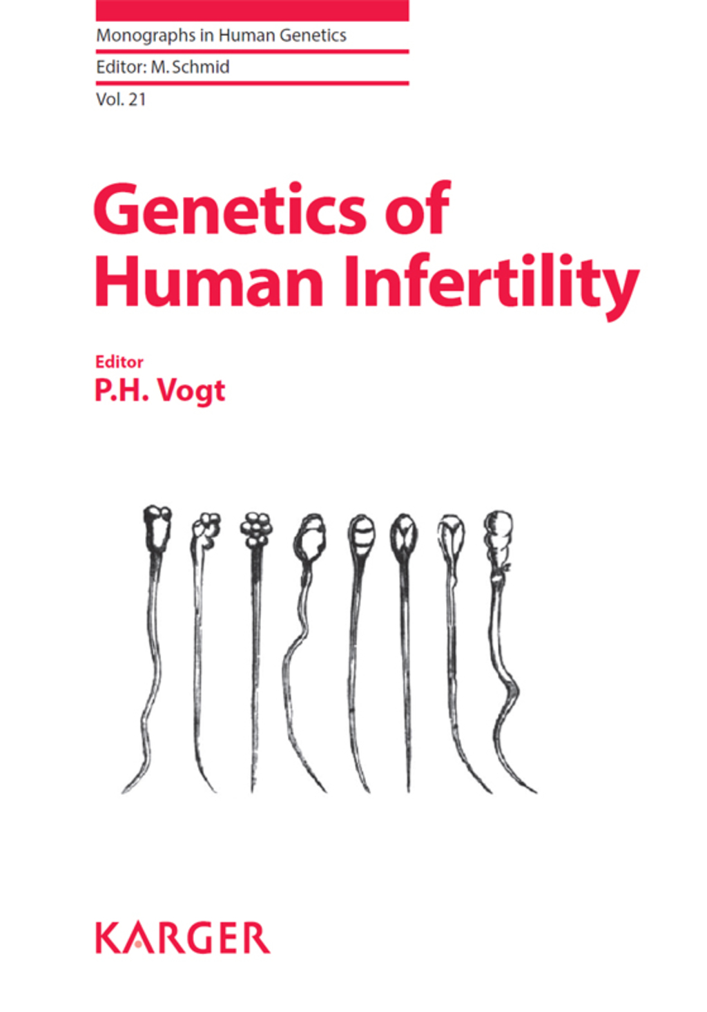 Genetics of Human Infertility 1st Edition