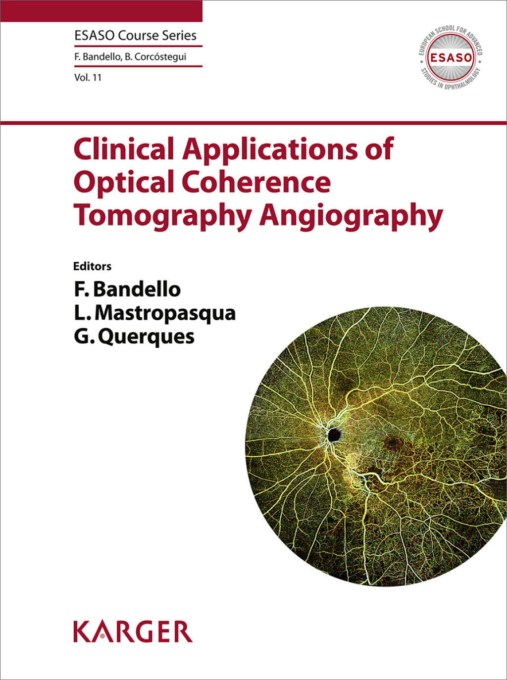 Clinical Applications of Optical Coherence Tomography Angiography 1st Edition