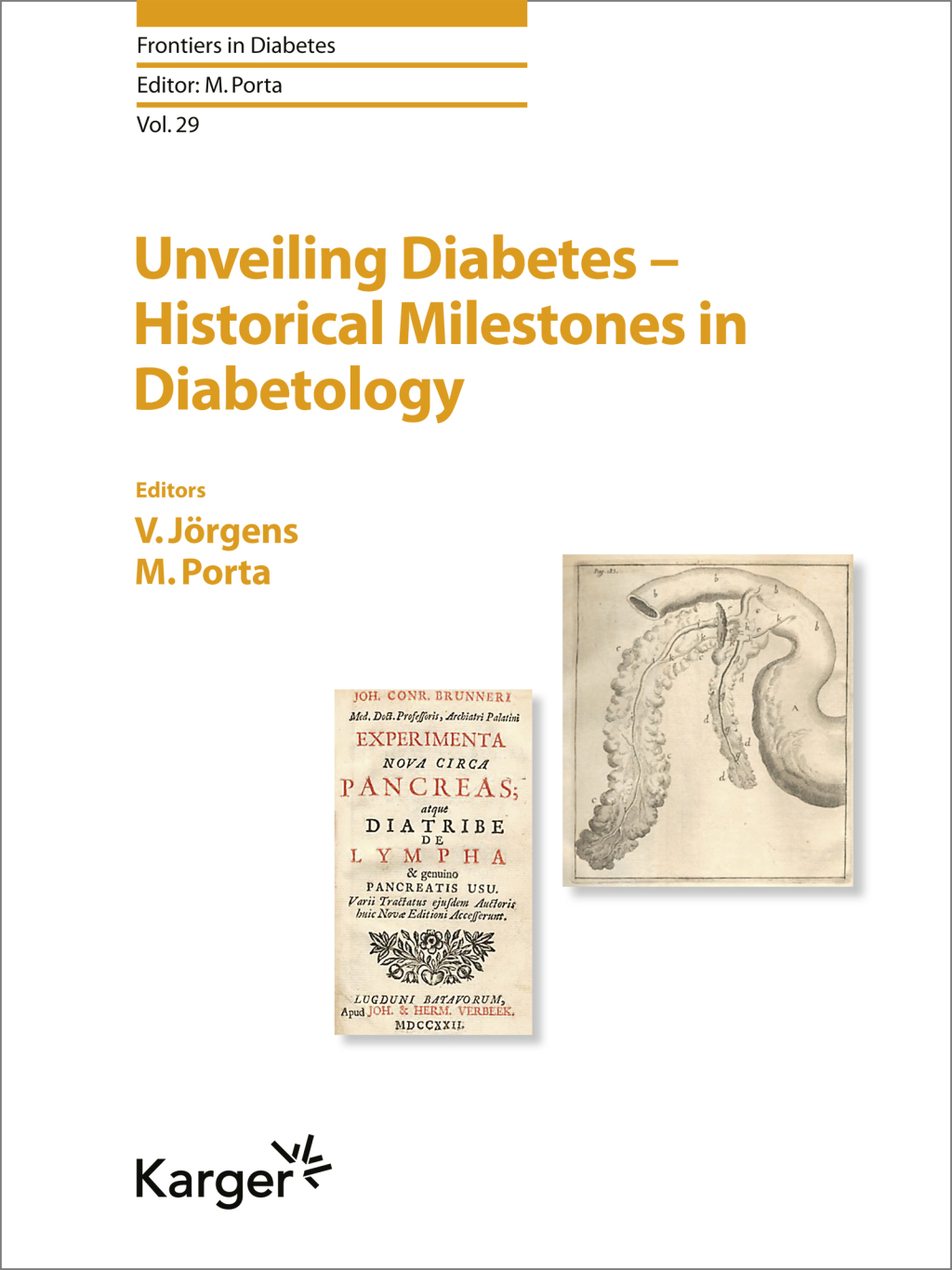 Unveiling Diabetes - Historical Milestones in Diabetology 1st Edition