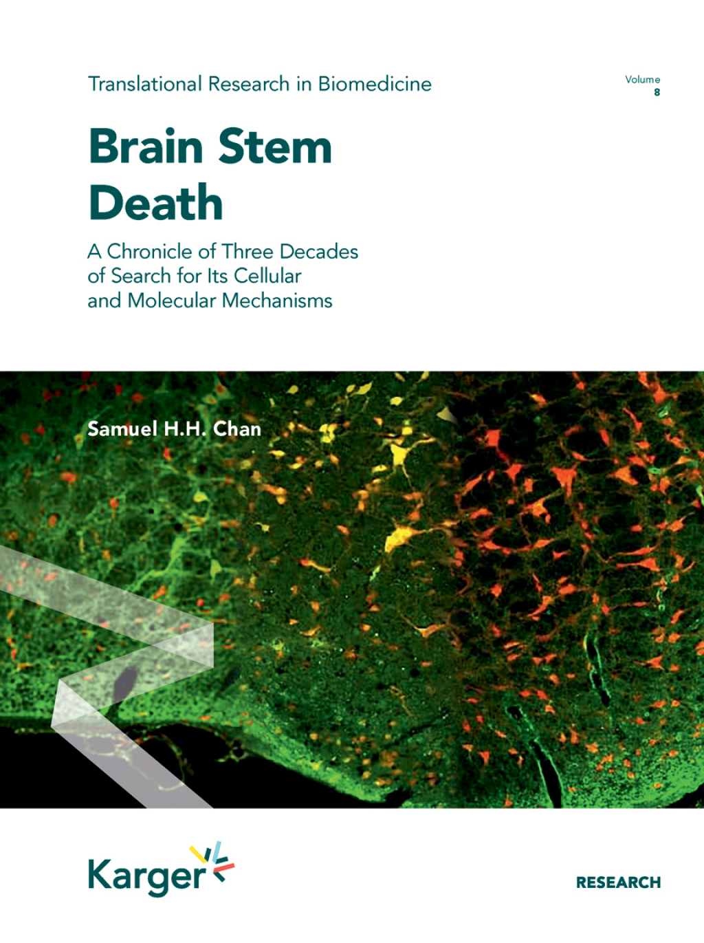Brain Stem Death A Chronicle of Three Decades of Search for Its Cellular and Molecular Mechanisms 1st Edition