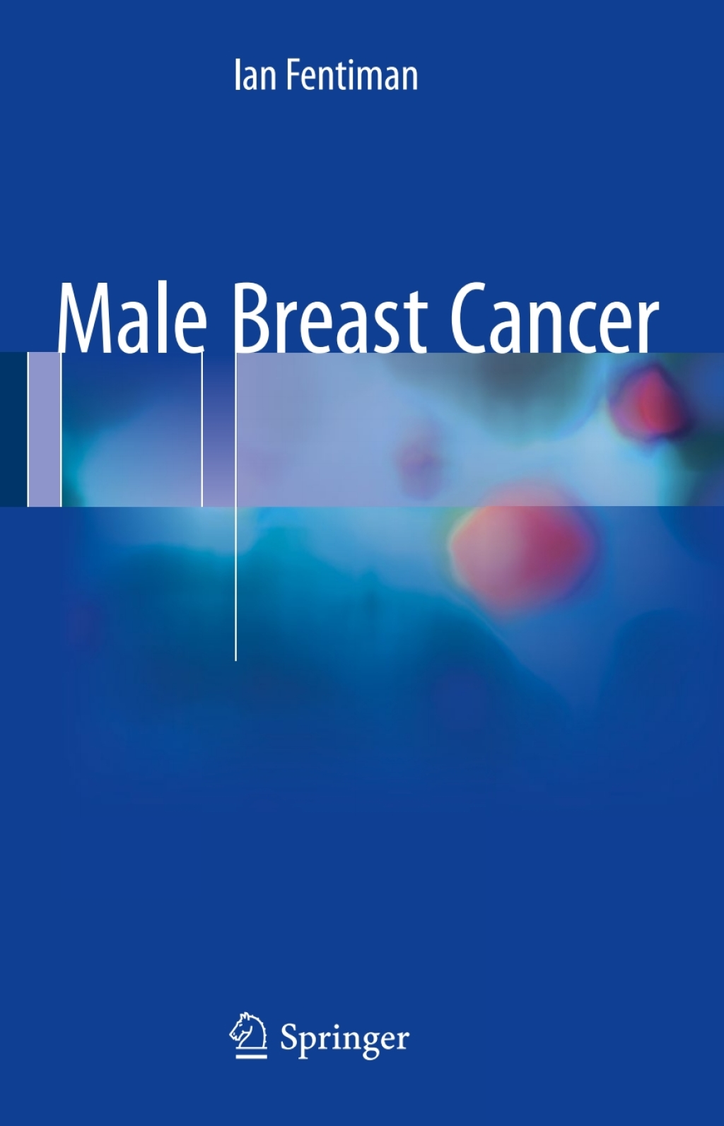 Male Breast Cancer 