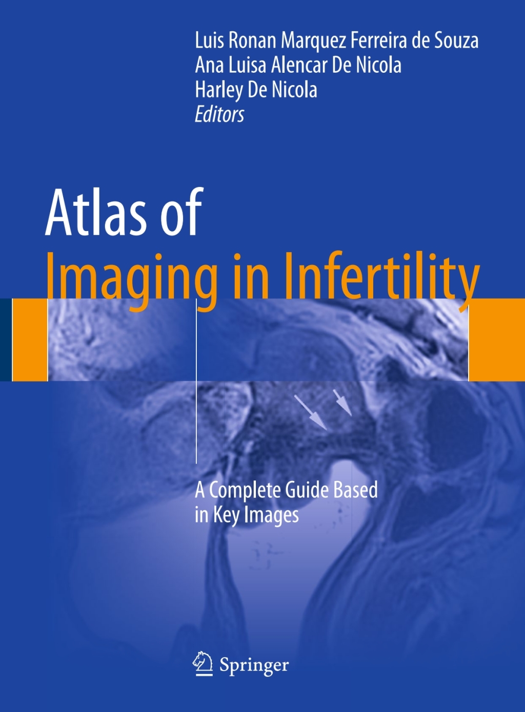 Atlas of Imaging in Infertility A Complete Guide Based in Key Images 