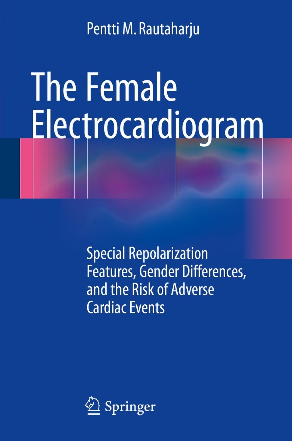 The Female Electrocardiogram Special Repolarization Features, Gender Differences, and the Risk of Adverse Cardiac Events 