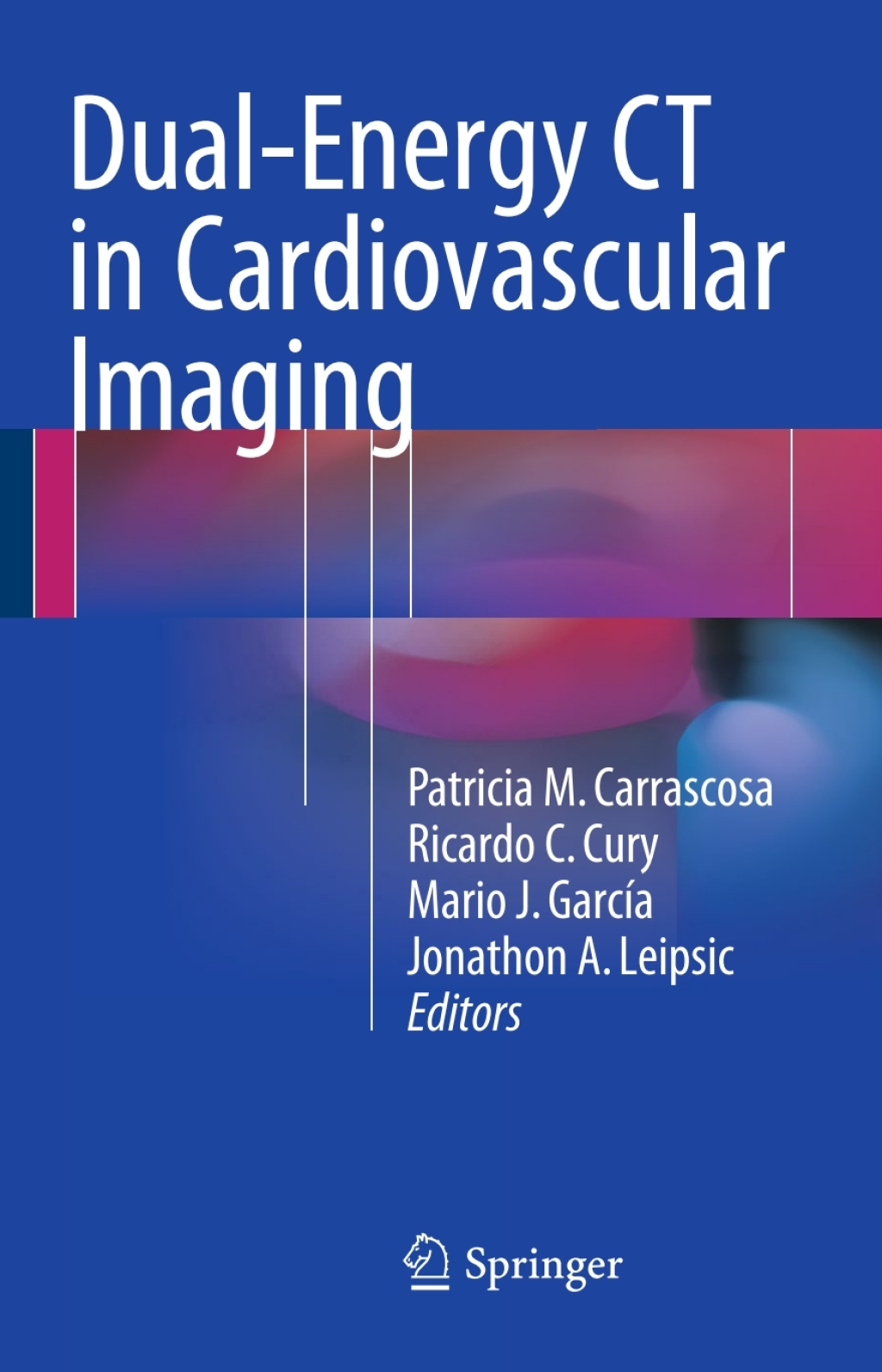 Dual-Energy CT in Cardiovascular Imaging 