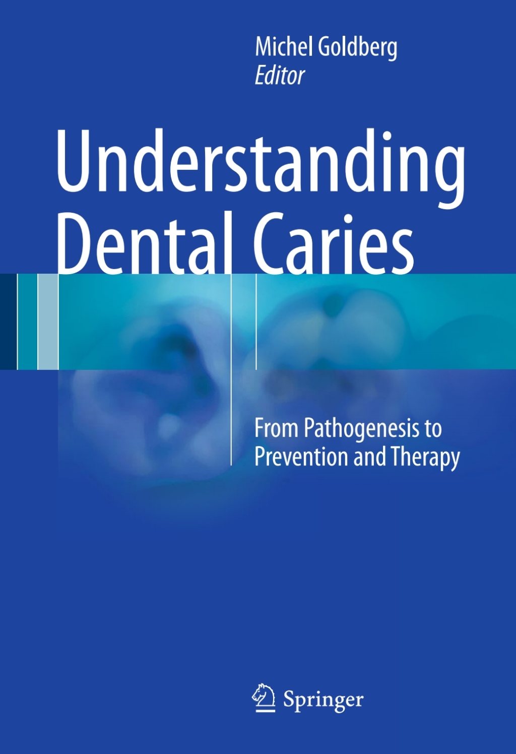 Understanding Dental Caries From Pathogenesis to Prevention and Therapy 