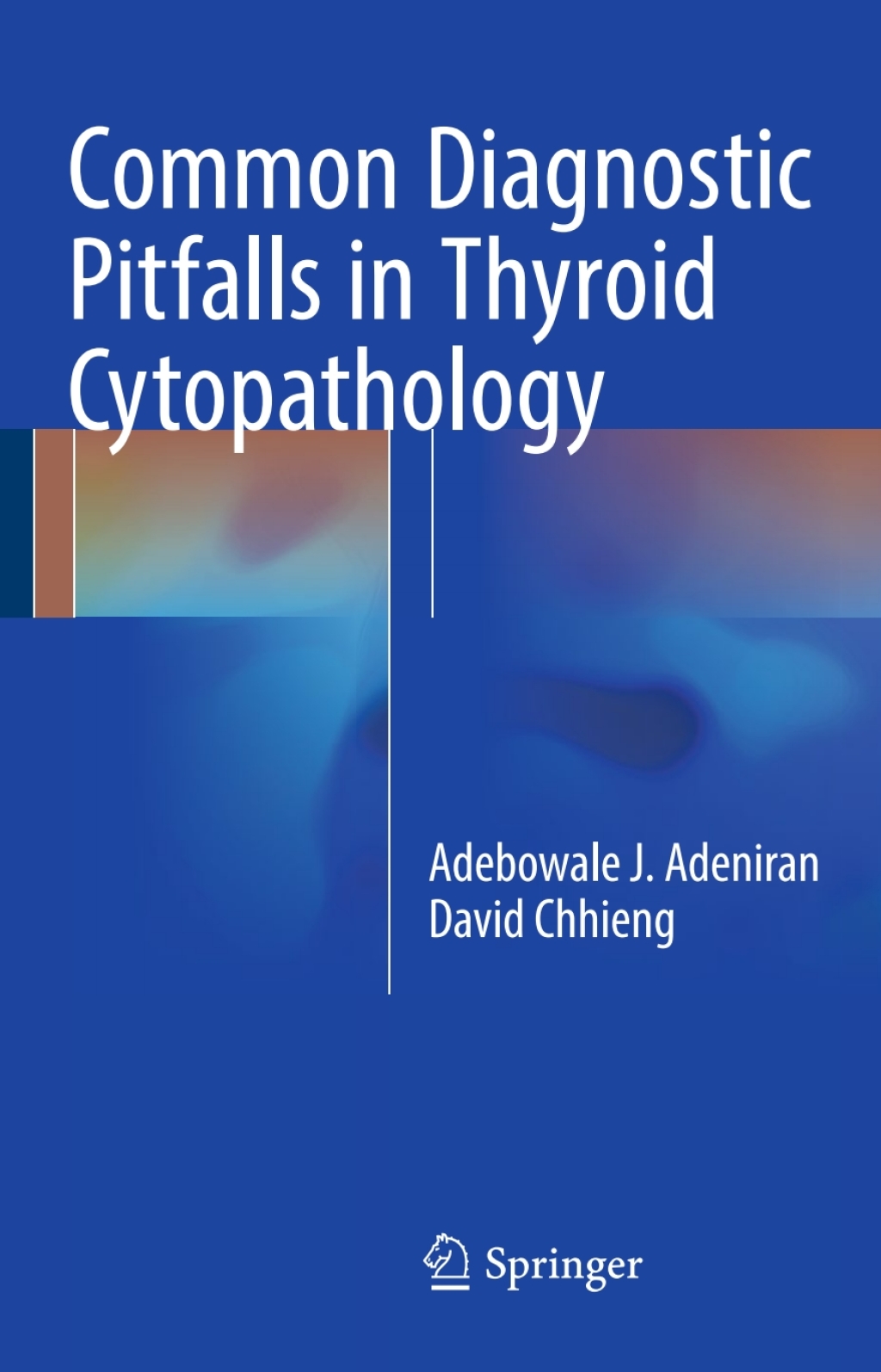 Common Diagnostic Pitfalls in Thyroid Cytopathology 