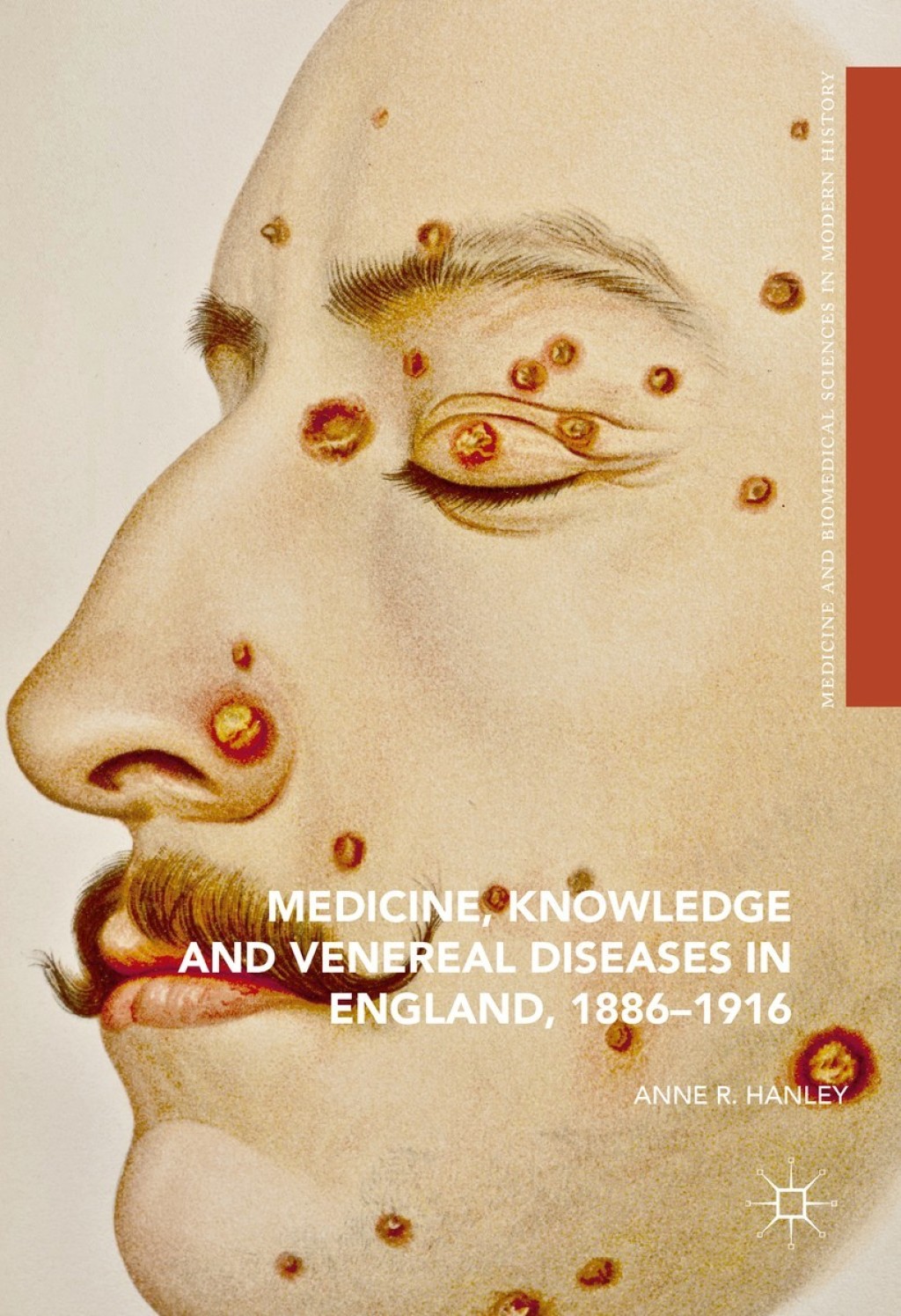 Medicine, Knowledge and Venereal Diseases in England, 1886-1916 