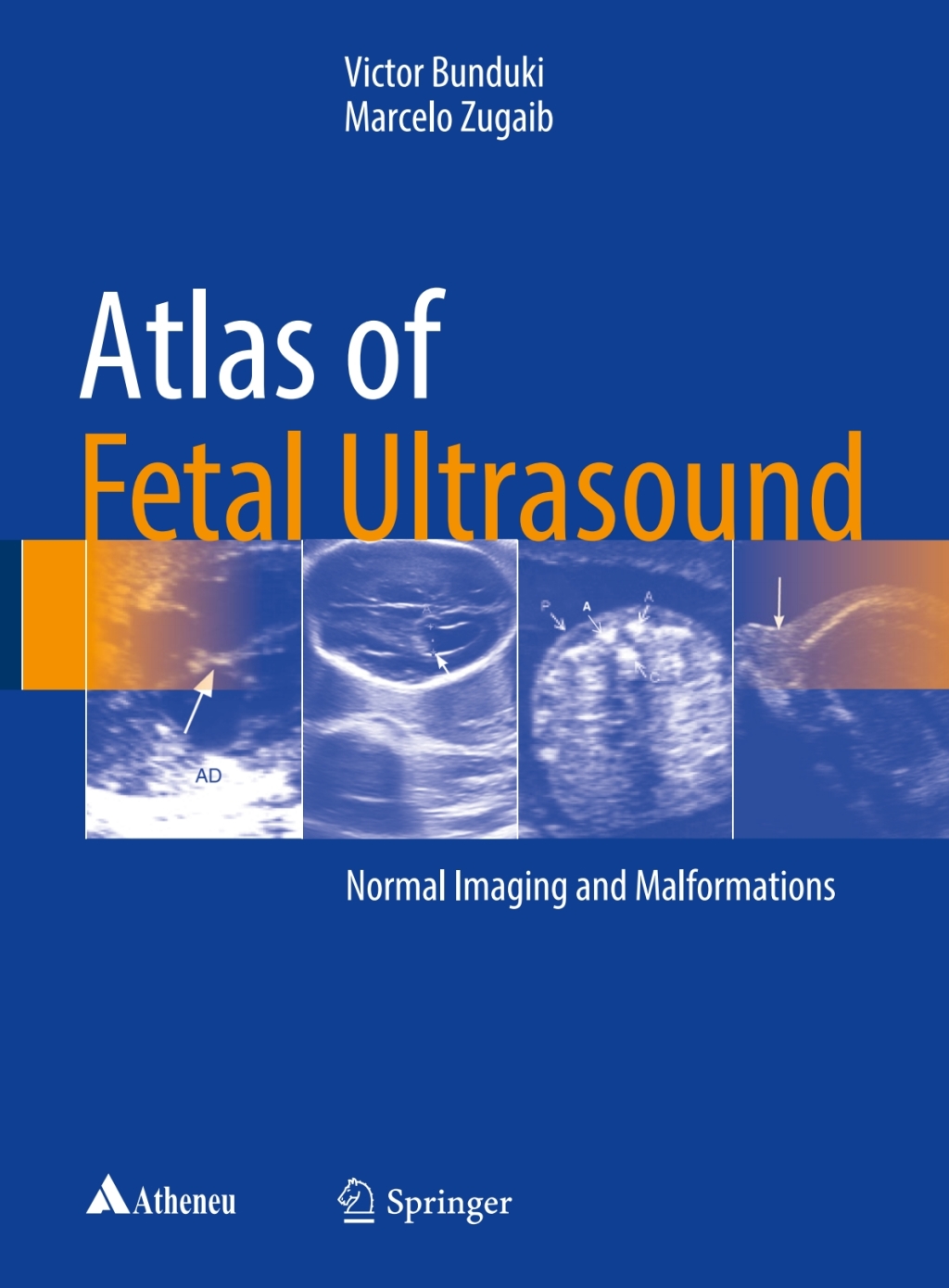 Atlas of Fetal Ultrasound Normal Imaging and Malformations 