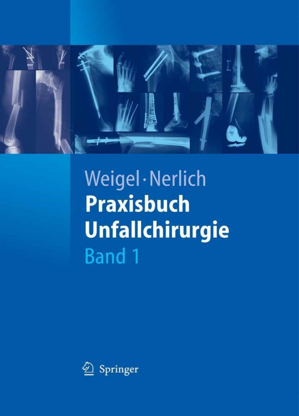 Praxisbuch Unfallchirurgie 1st Edition