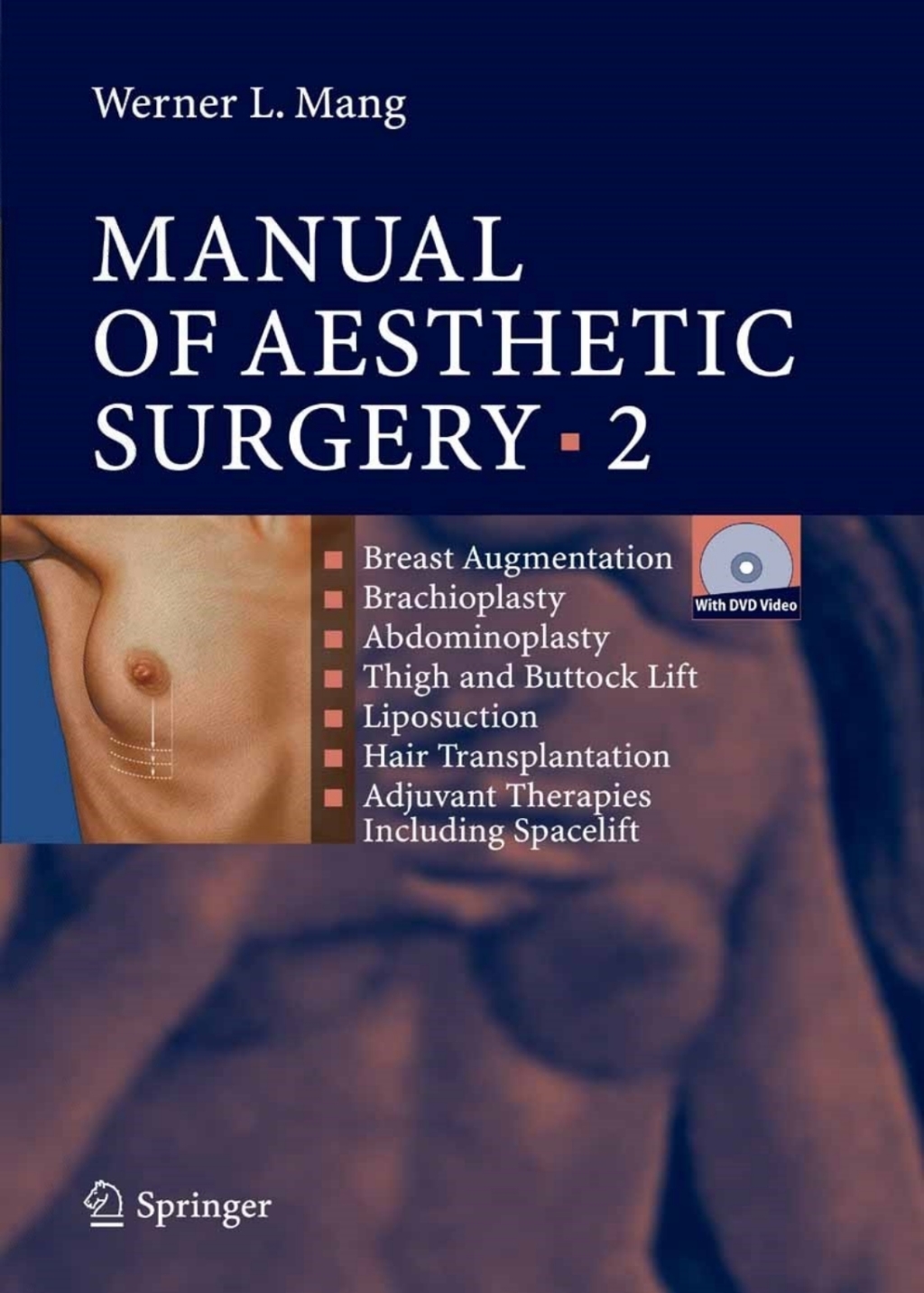 Manual of Aesthetic Surgery 2 Breast Augmentation; Brachioplasty; Abdominoplasty; Thigh and Buttock Lift; Liposuction; Hair Transplantation; Adjuvant Therapies including Space Lift 