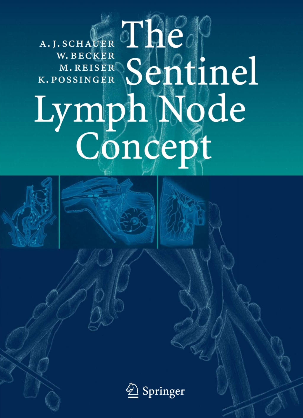 The Sentinel Lymph Node Concept 