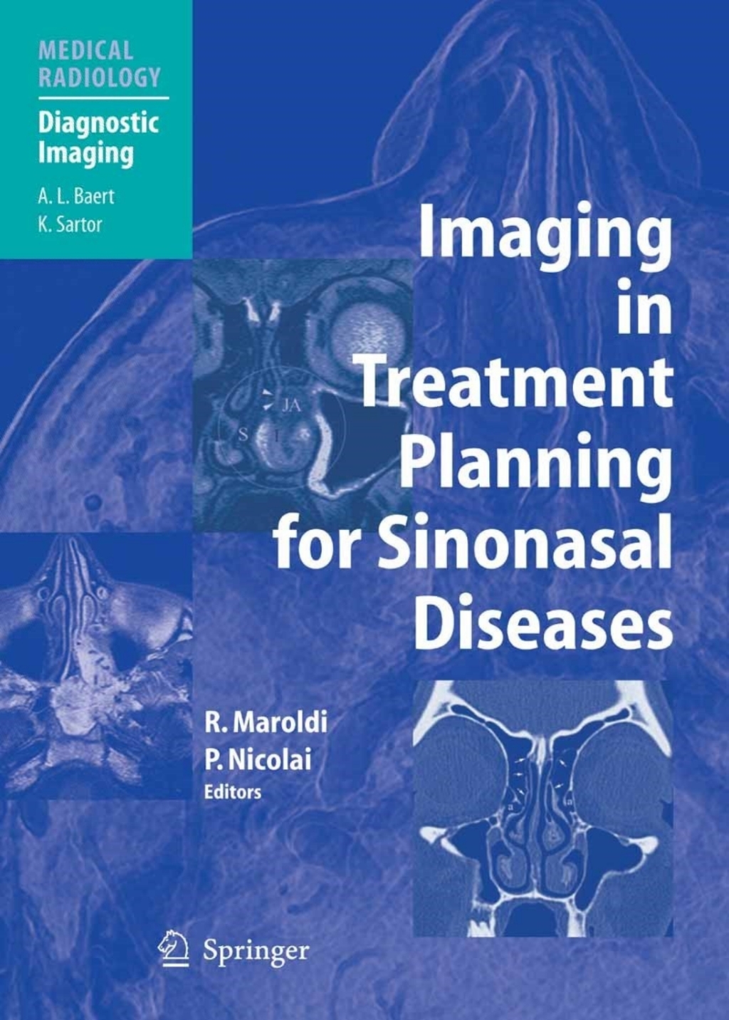 Imaging in Treatment Planning for Sinonasal Diseases 1st Edition