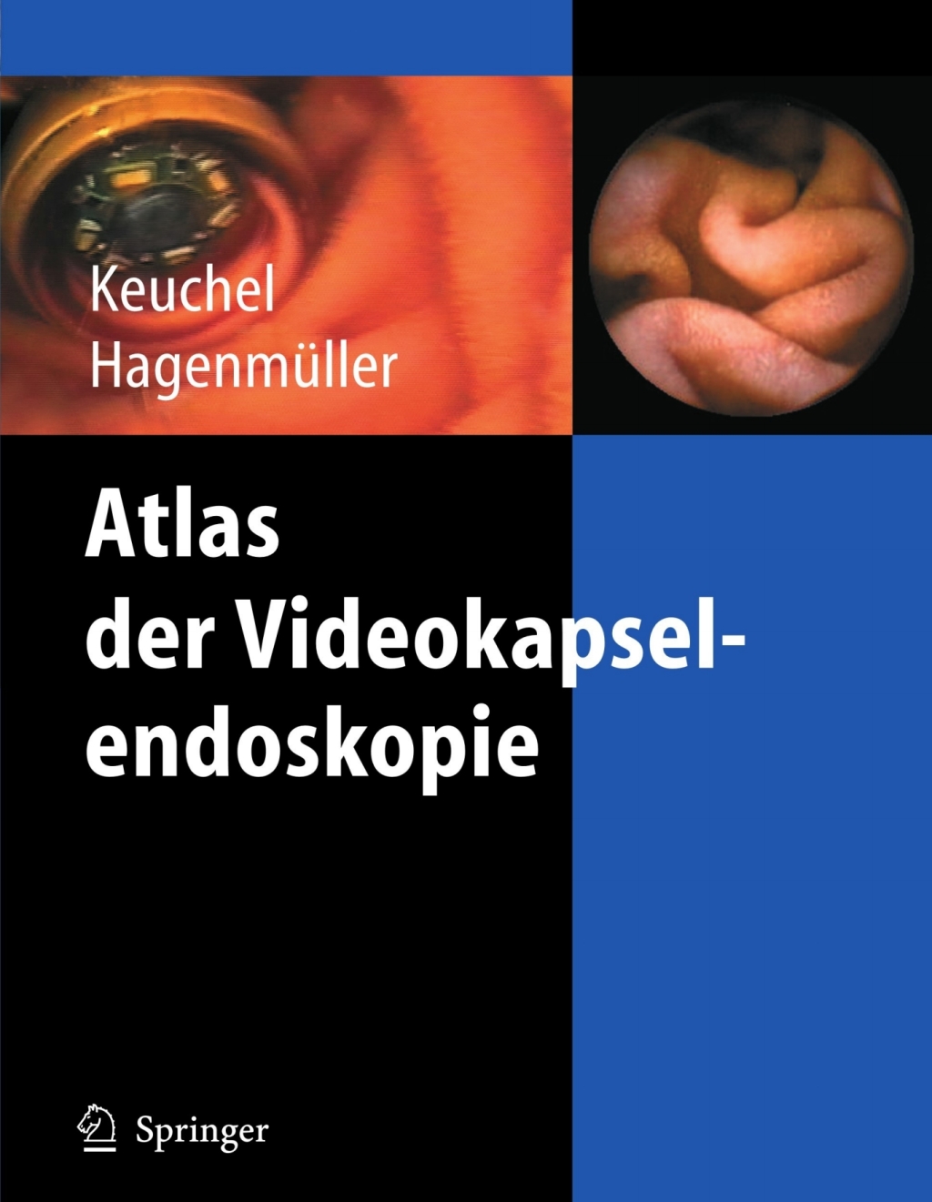 Atlas der Videokapselendoskopie 1st Edition