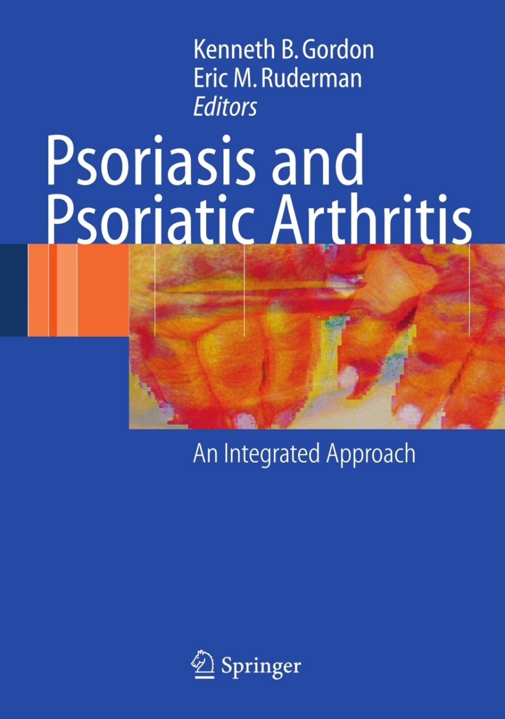 Psoriasis and Psoriatic Arthritis An Integrated Approach 1st Edition