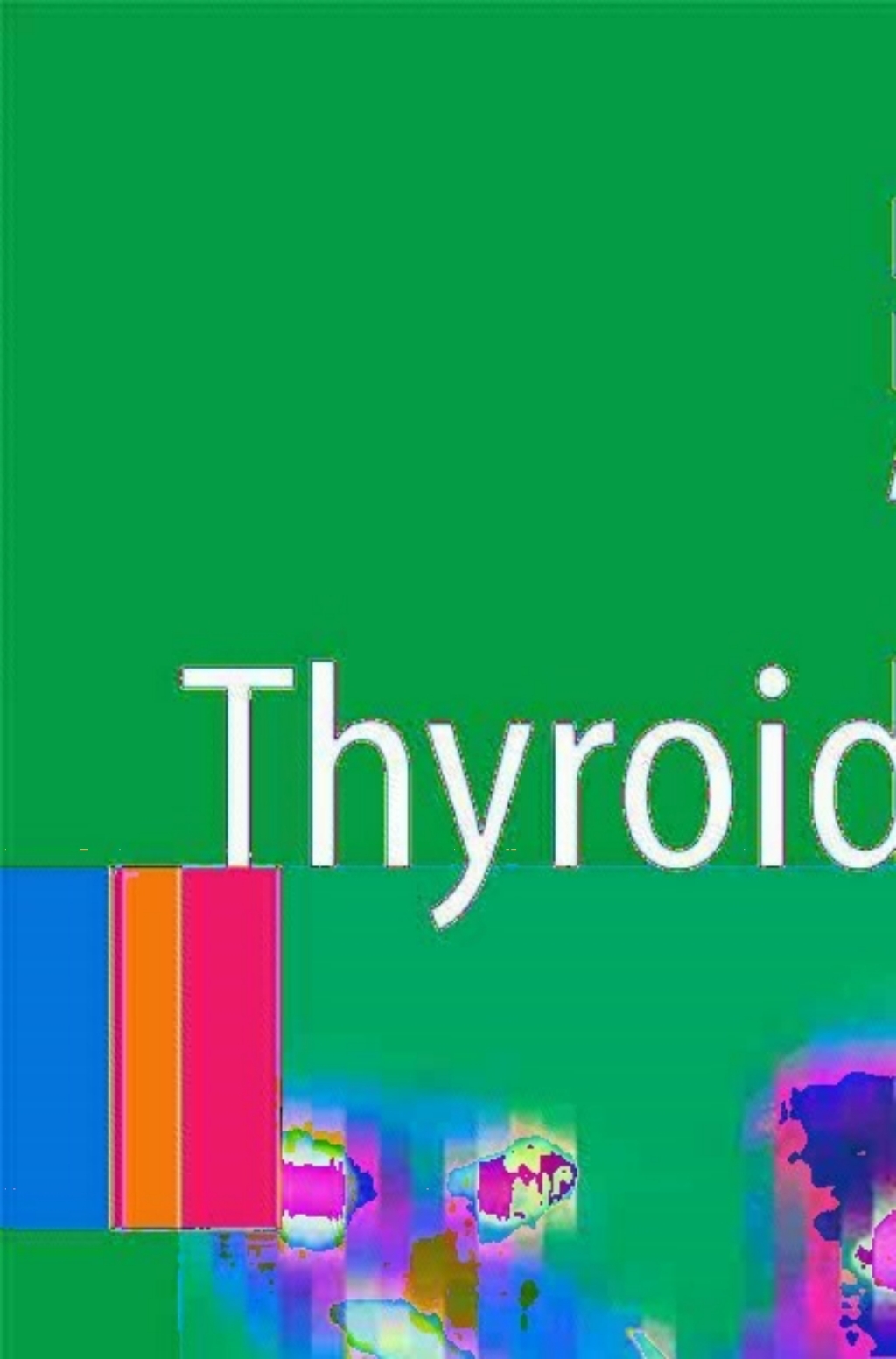 Thyroid Cancer 2nd Edition