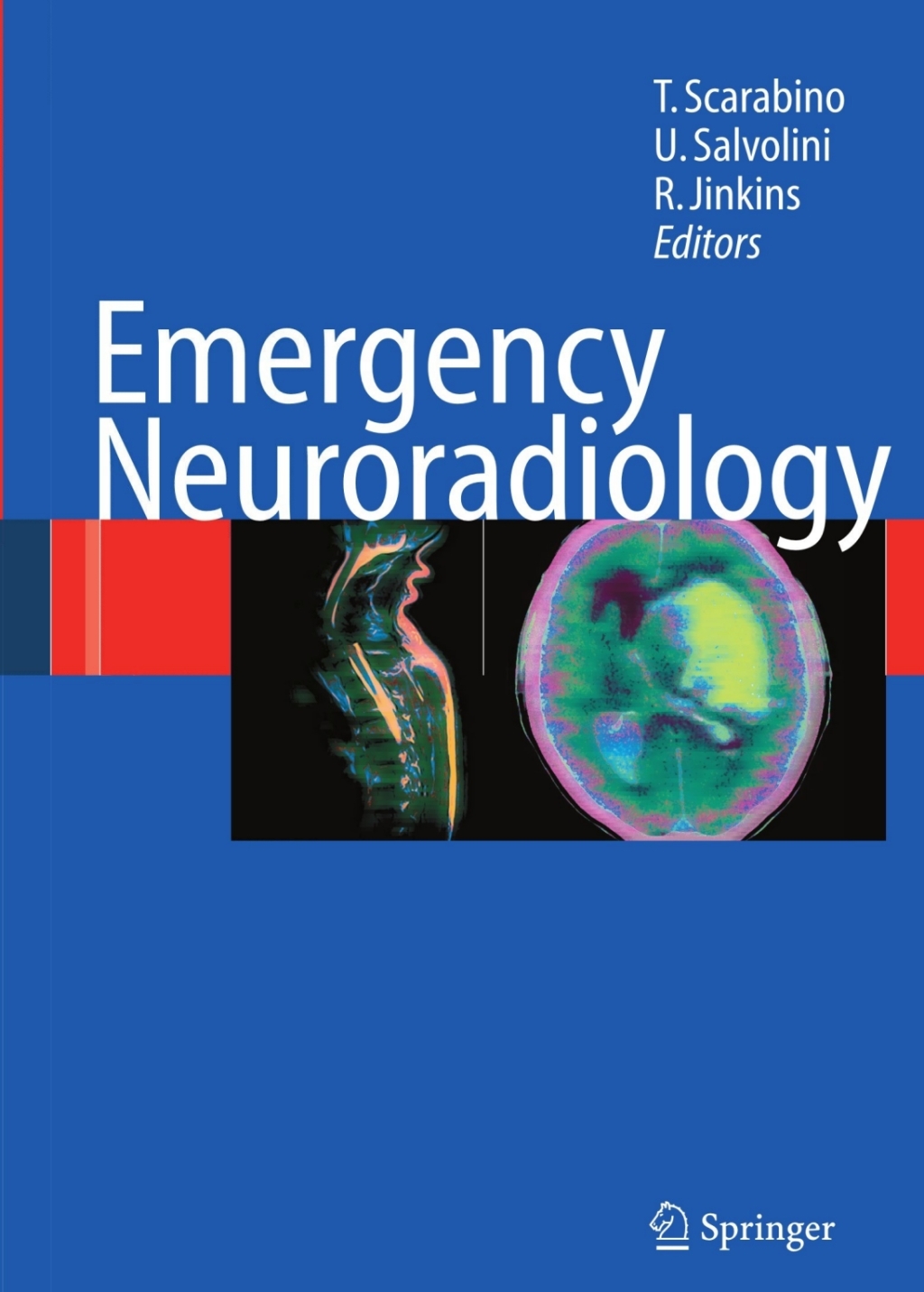 Emergency Neuroradiology 1st Edition