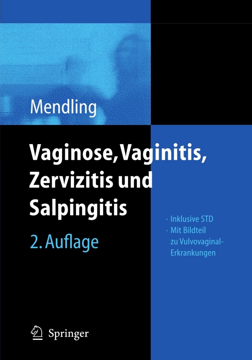 Vaginose, Vaginitis, Zervizitis und Salpingitis 2nd Edition