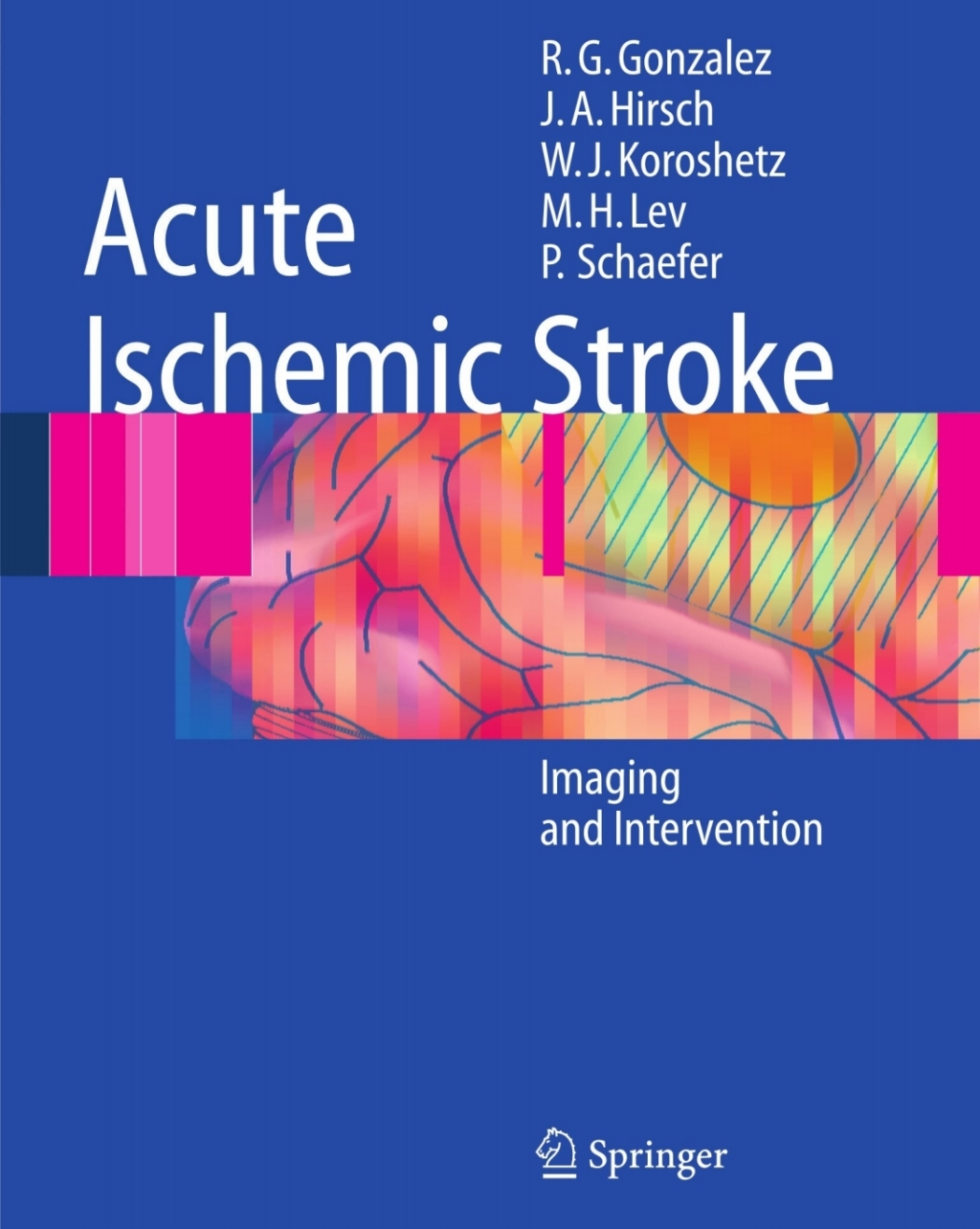 Acute Ischemic Stroke Imaging and Intervention 