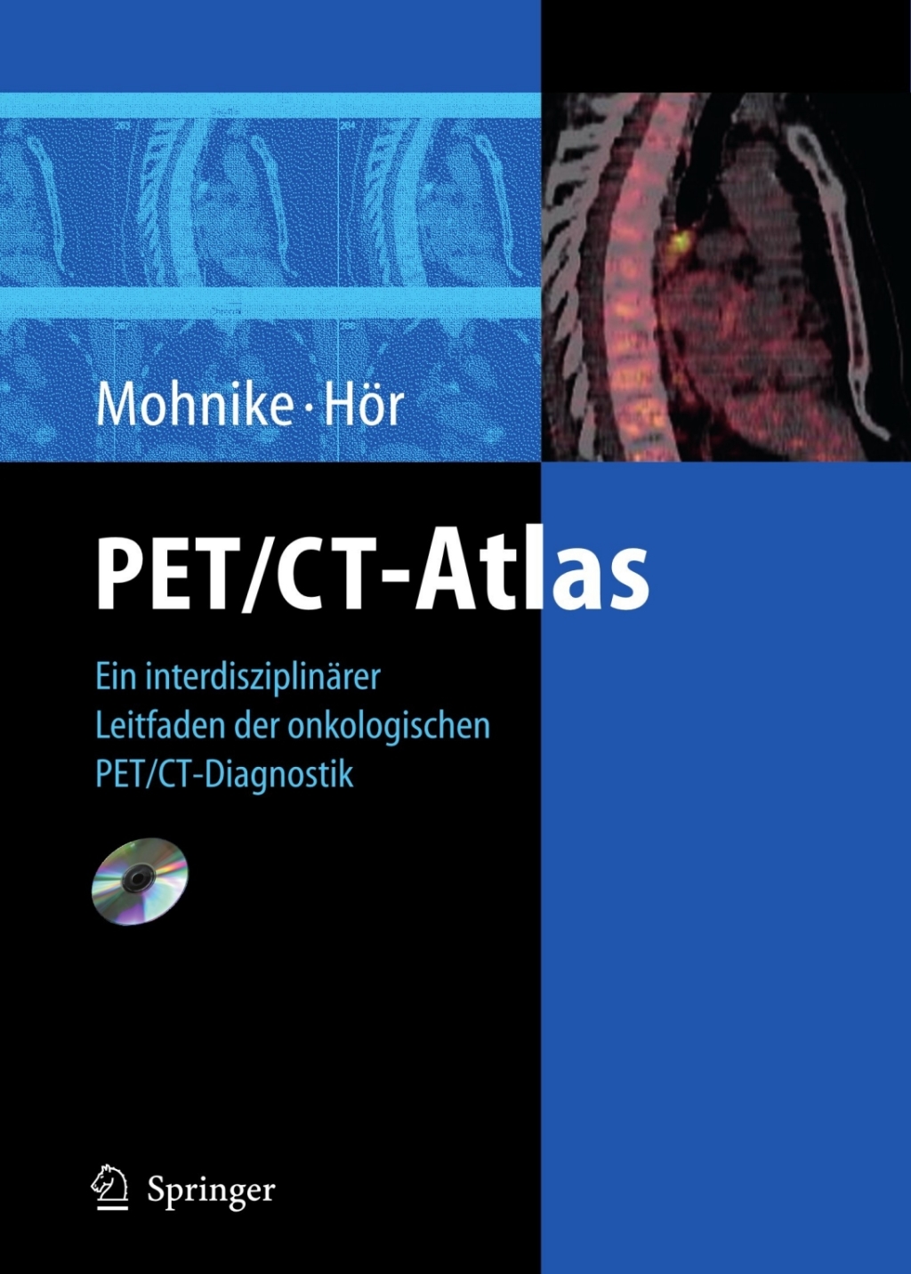 PET/CT-Atlas Ein interdisziplinÃƒÂ¤rer Leitfaden der onkologischen PET/CT-Diagnostik 1st Edition