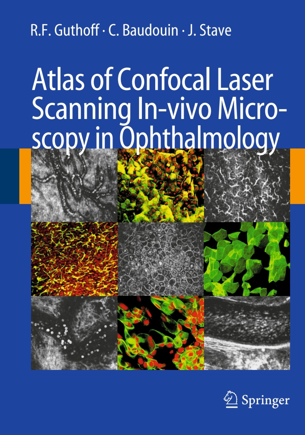 Atlas of Confocal Laser Scanning In-vivo Microscopy in Ophthalmology 
