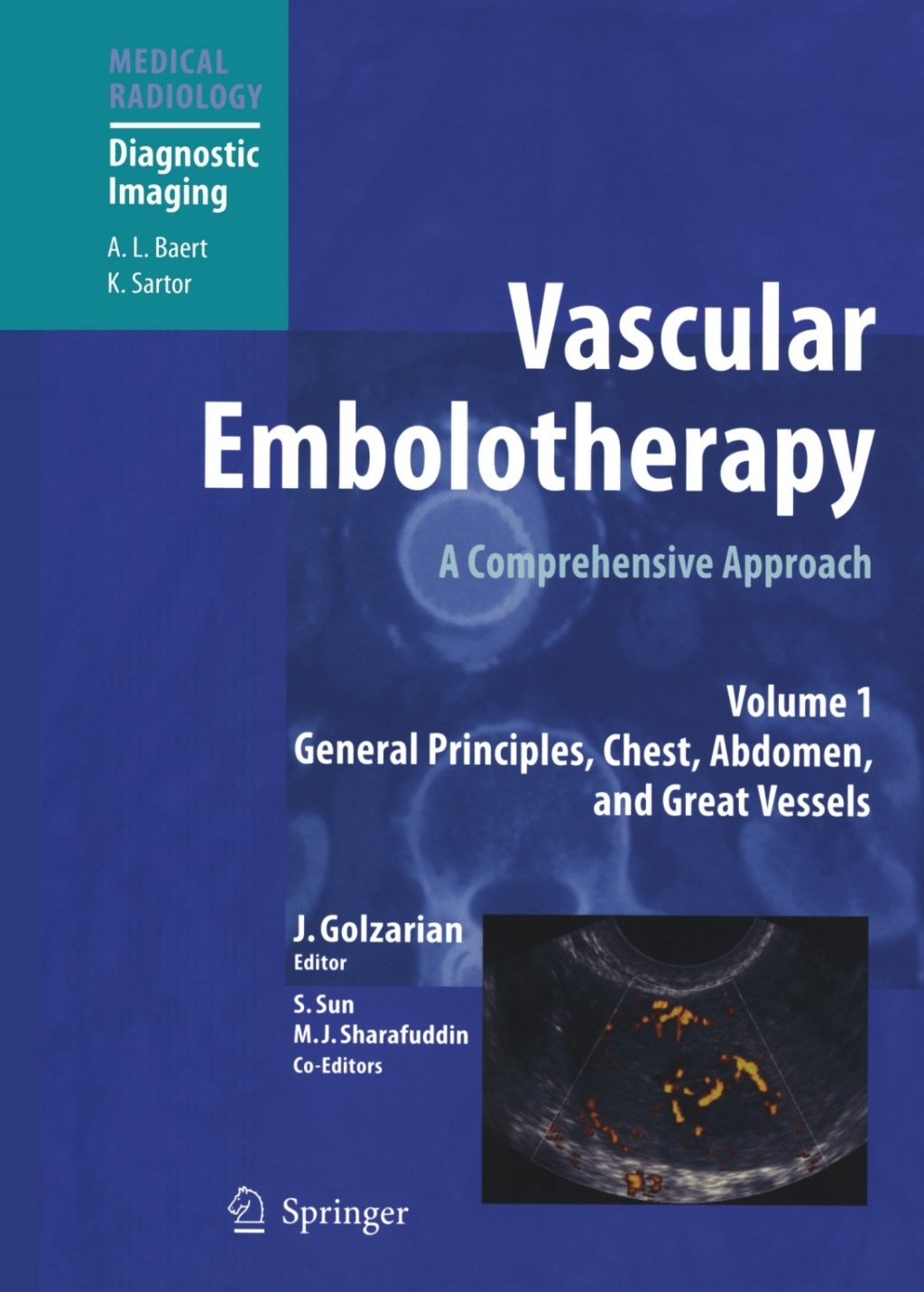 Vascular Embolotherapy A Comprehensive Approach, Volume 1: General Principles, Chest, Abdomen, and Great Vessels 1st Edition