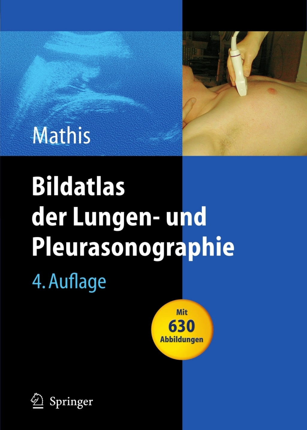 Bildatlas der Lungen- und Pleurasonographie 4th Edition