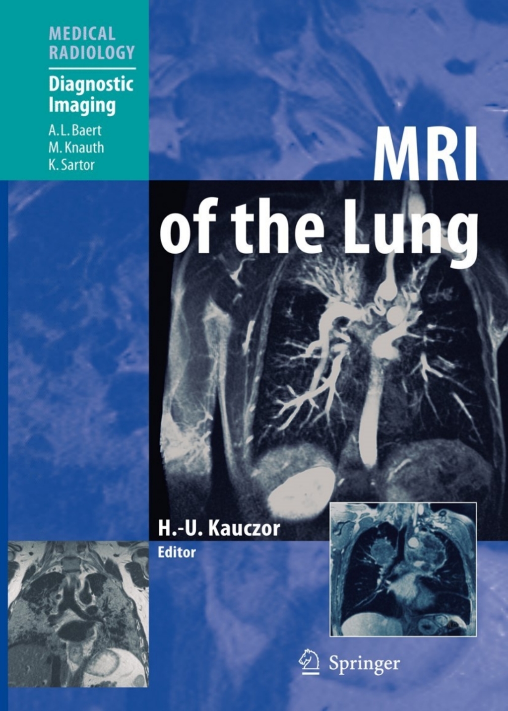 MRI of the Lung 1st Edition