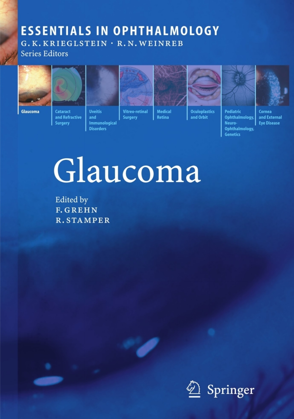 Glaucoma 1st Edition