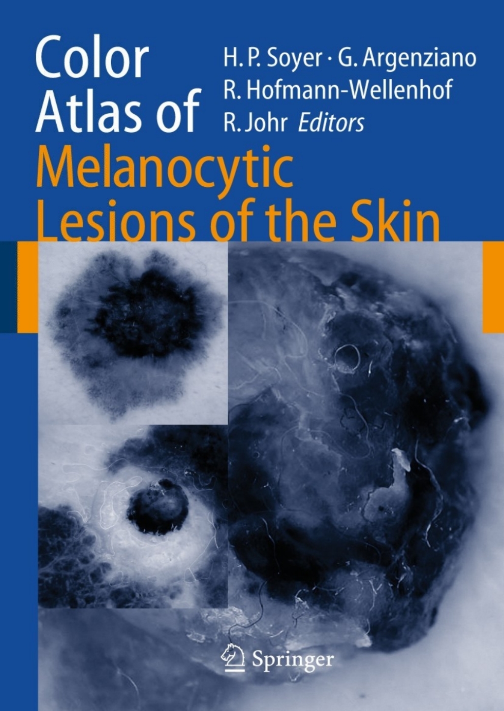 Color Atlas of Melanocytic Lesions of the Skin 1st Edition
