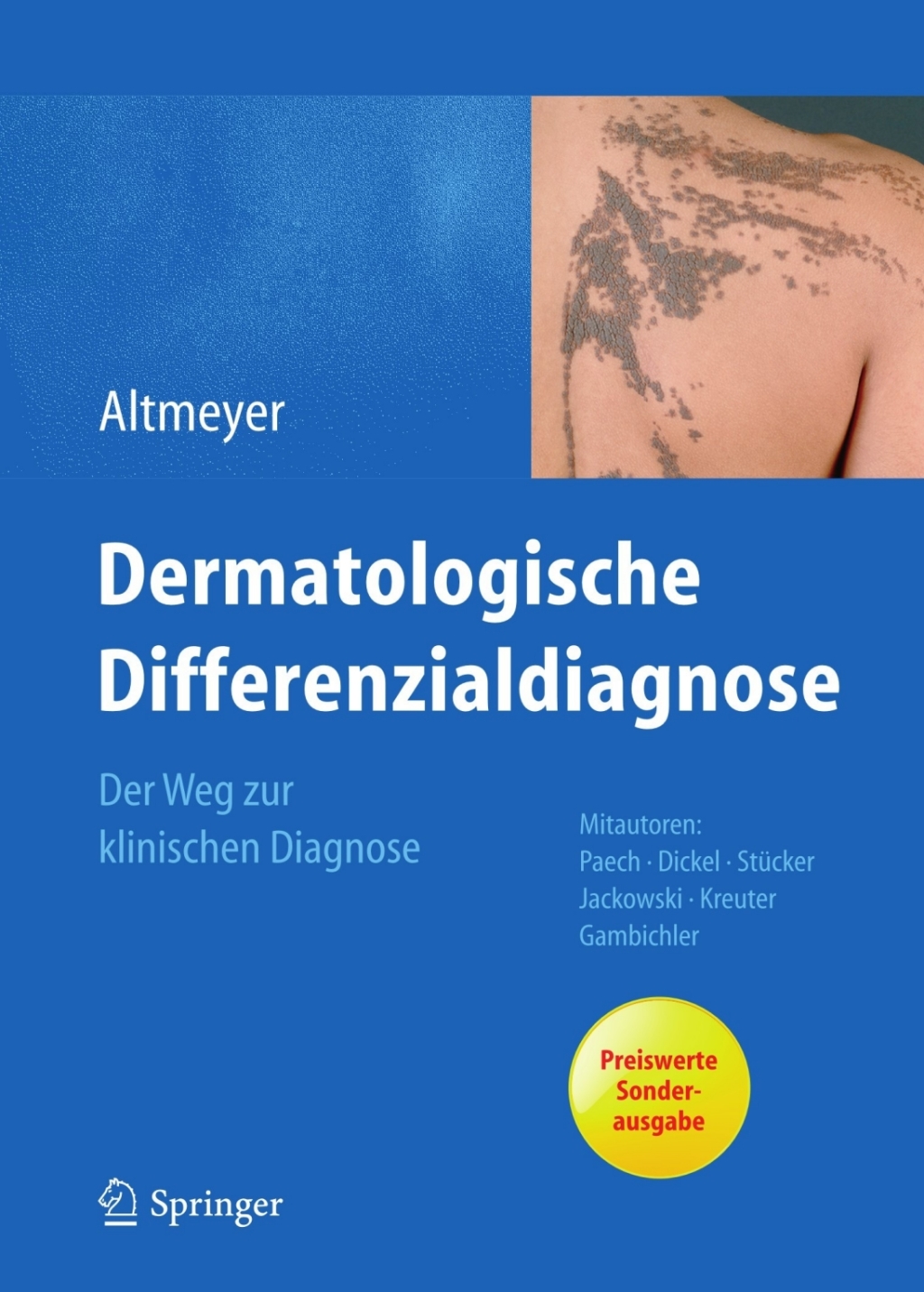 Dermatologische Differenzialdiagnose Der Weg zur klinischen Diagnose 