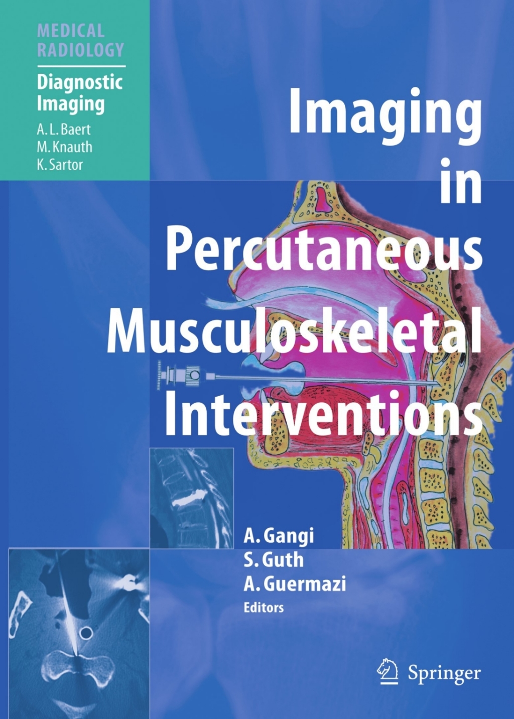 Imaging in Percutaneous Musculoskeletal Interventions 1st Edition