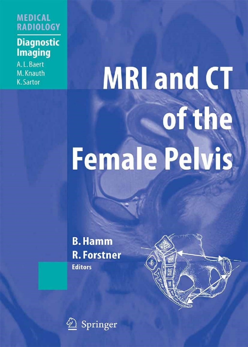 MRI and CT of the Female Pelvis 1st Edition