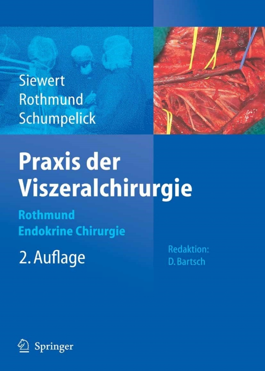 Praxis der Viszeralchirurgie Endokrine Chirurgie 2nd Edition