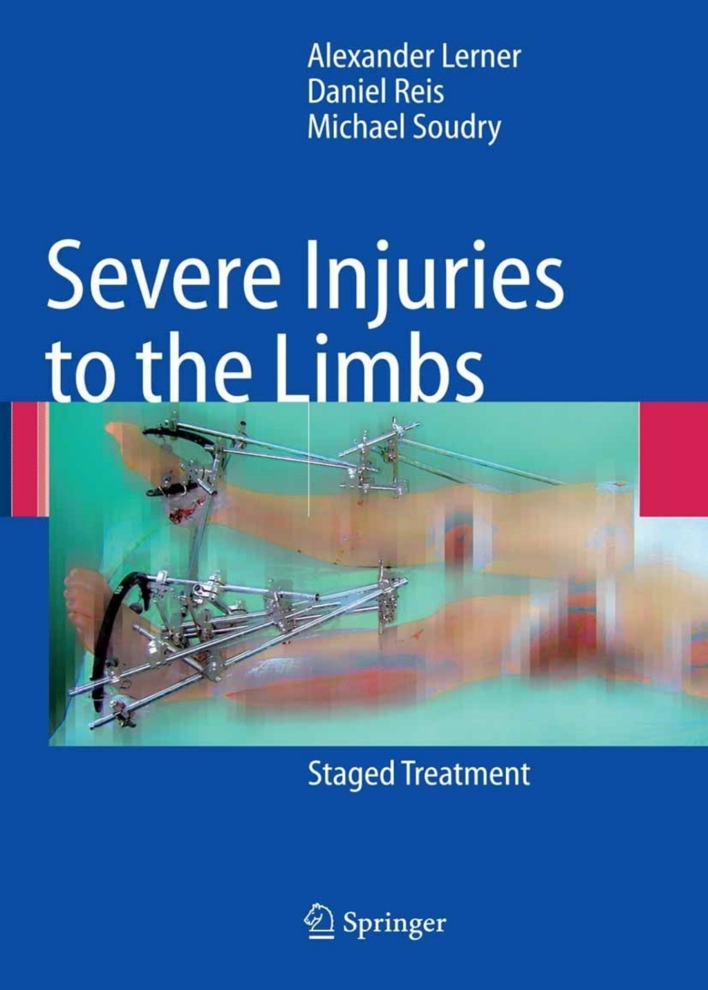 Severe Injuries to the Limbs Staged Treatment 
