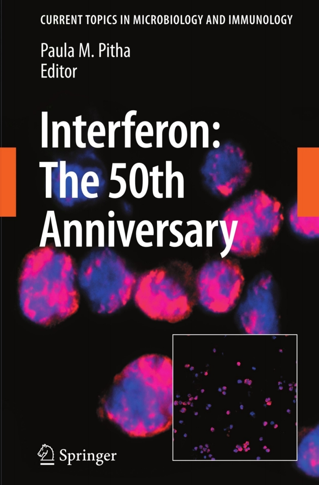 Interferon: The 50th Anniversary 1st Edition