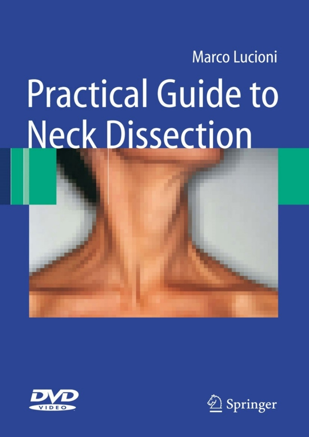 Practical Guide to Neck Dissection 