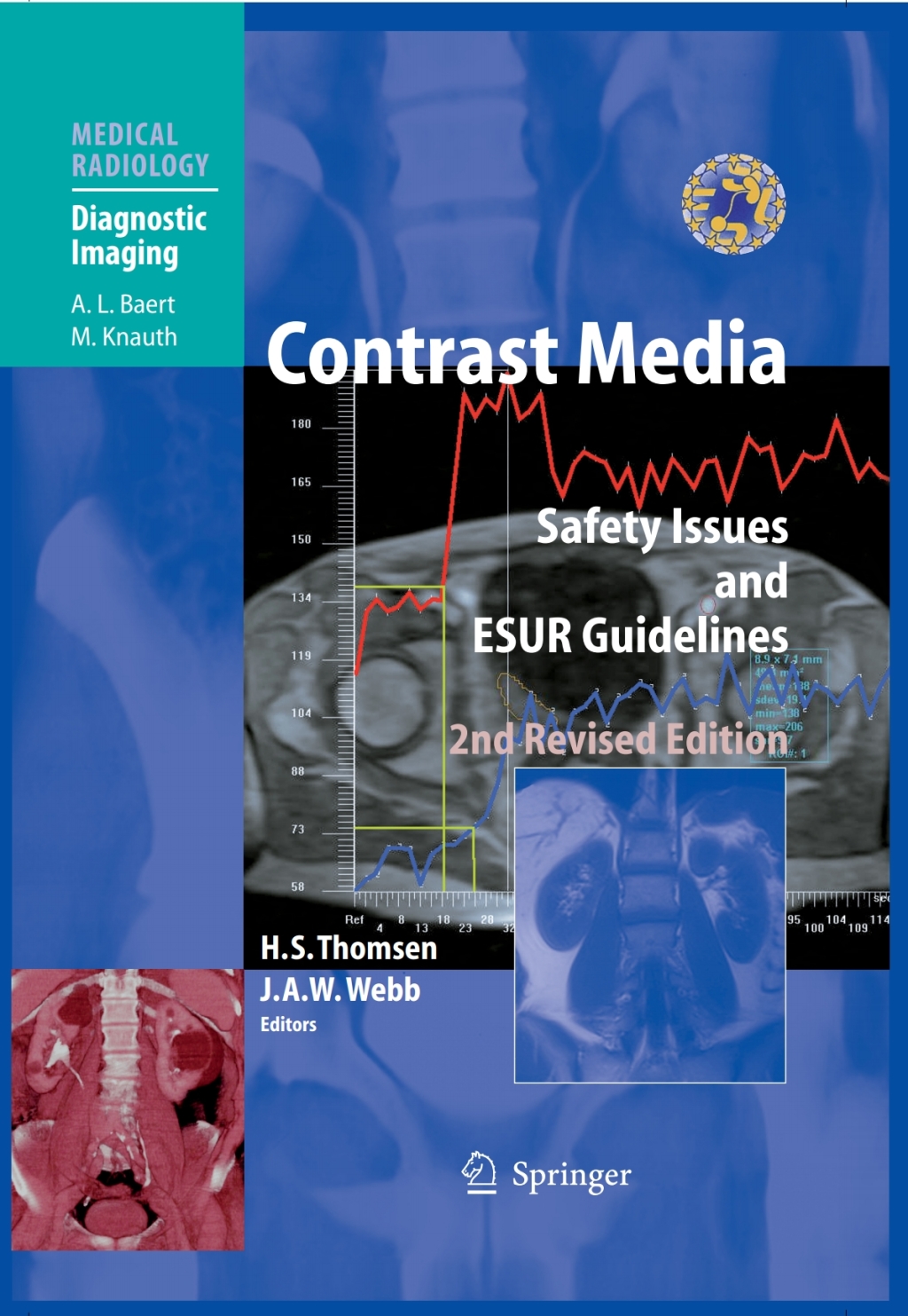 Contrast Media Safety Issues and ESUR Guidelines 2nd Edition