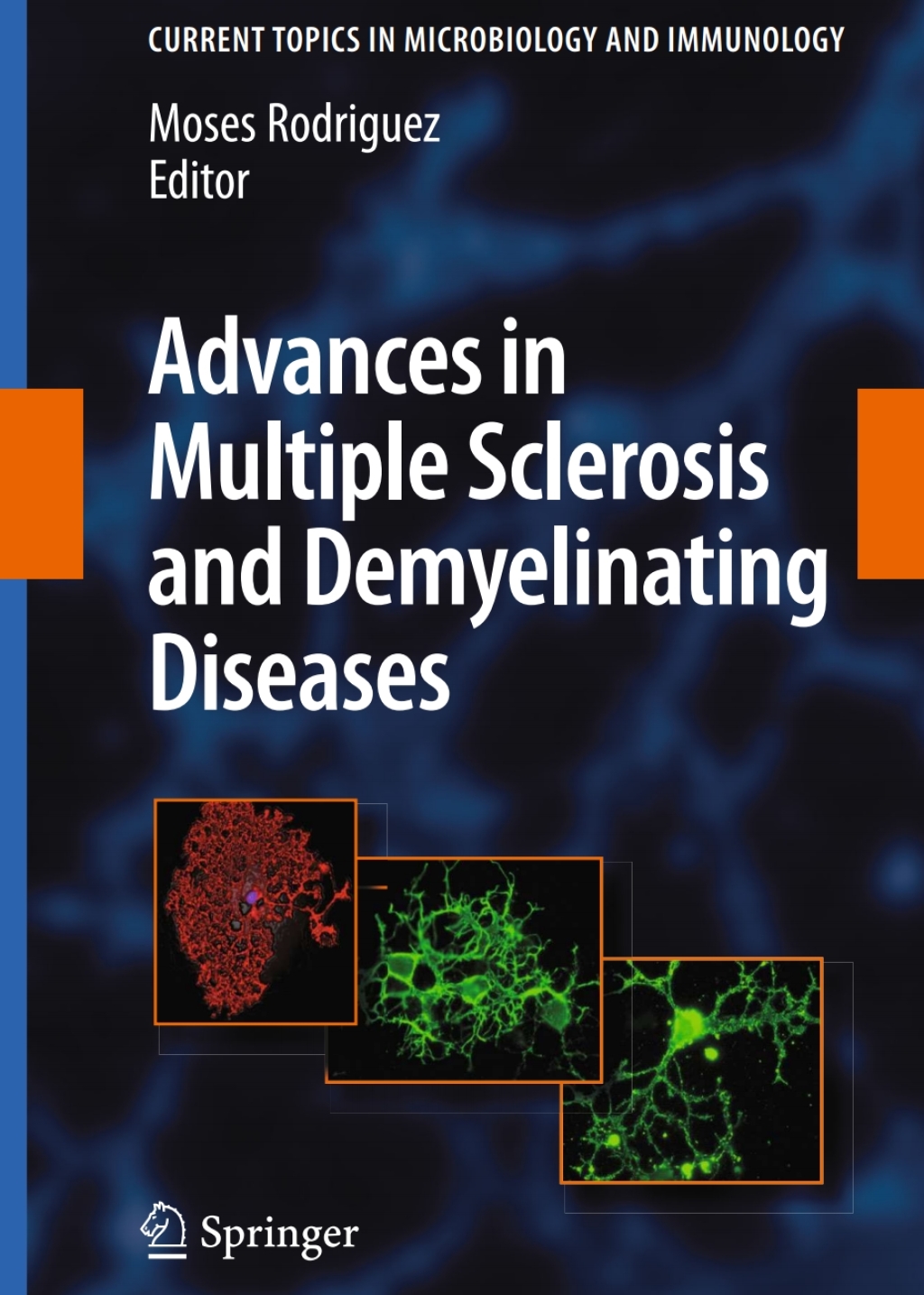 Advances in Multiple Sclerosis and Experimental Demyelinating Diseases 1st Edition
