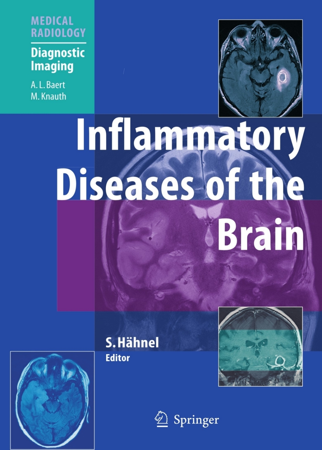 Inflammatory Diseases of the Brain 1st Edition