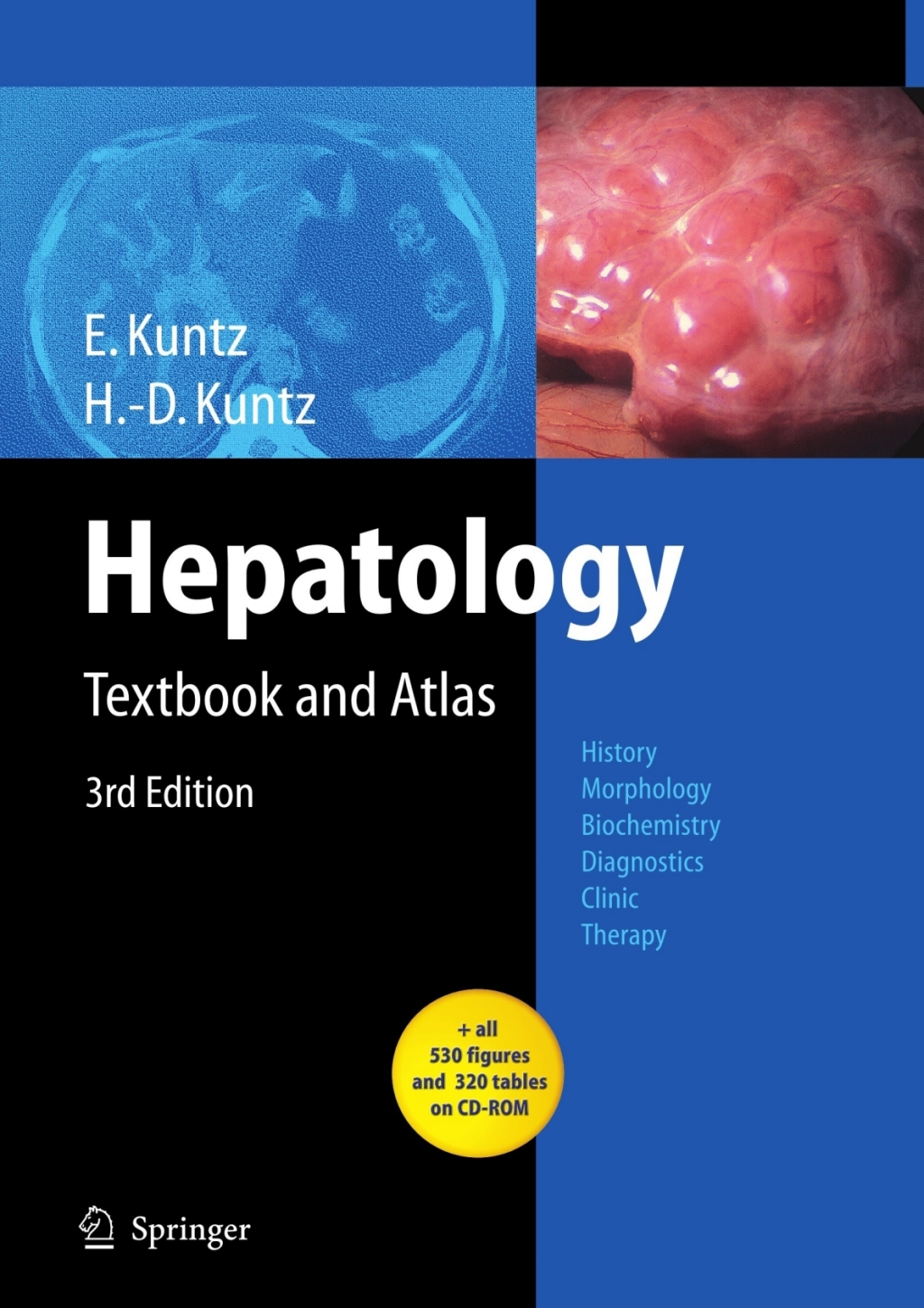 Hepatology Textbook and Atlas 3rd Edition