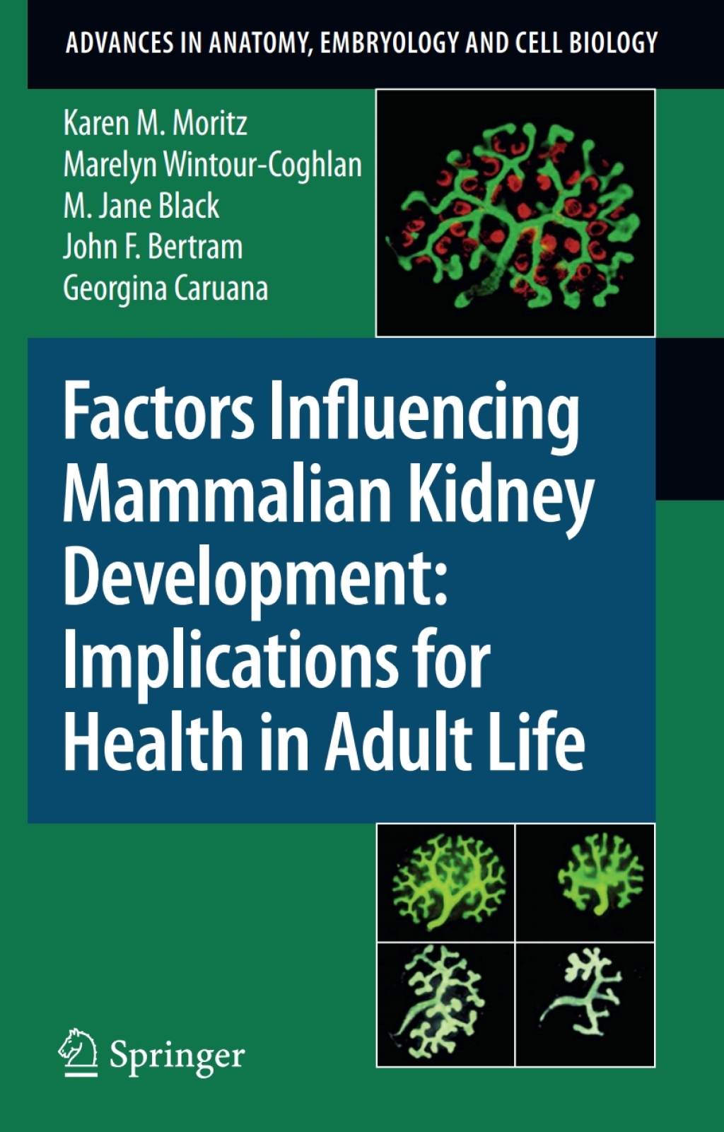 Factors Influencing Mammalian Kidney Development: Implications for Health in Adult Life 