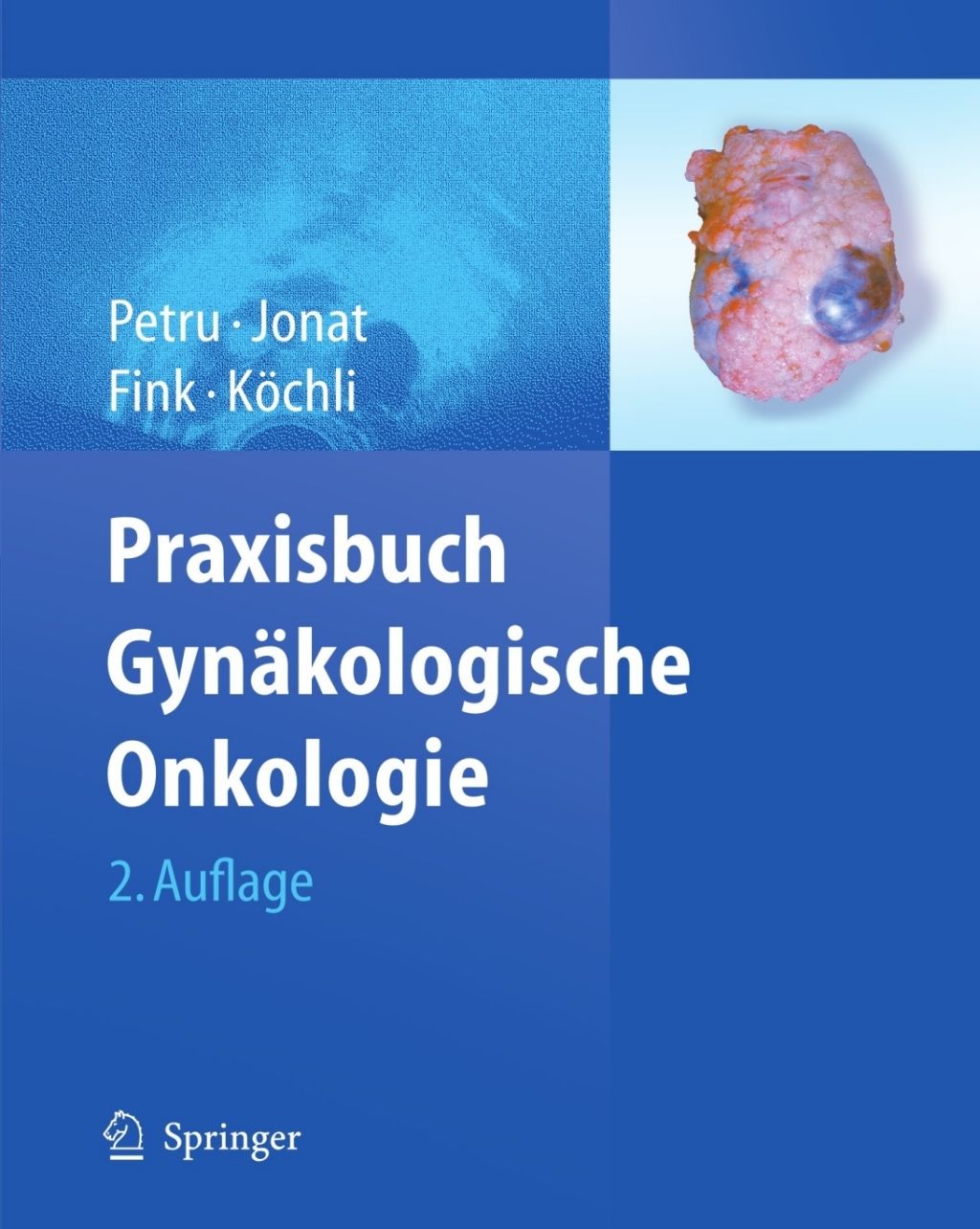 Praxisbuch GynÃƒÂ¤kologische Onkologie 2nd Edition
