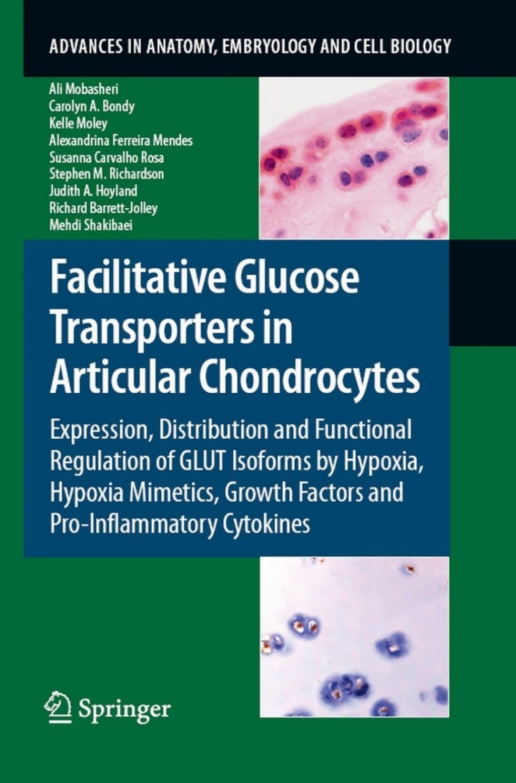 Facilitative Glucose Transporters in Articular Chondrocytes Expression, Distribution and Functional Regulation of GLUT Isoforms by Hypoxia, Hypoxia Mimetics, Growth Factors and Pro-Inflammatory Cytokines 