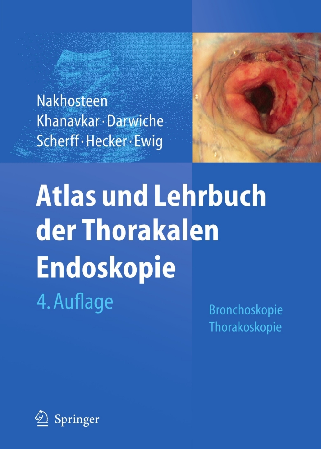 Atlas und Lehrbuch der Thorakalen Endoskopie Bronchoskopie, Thorakoskopie 4th Edition