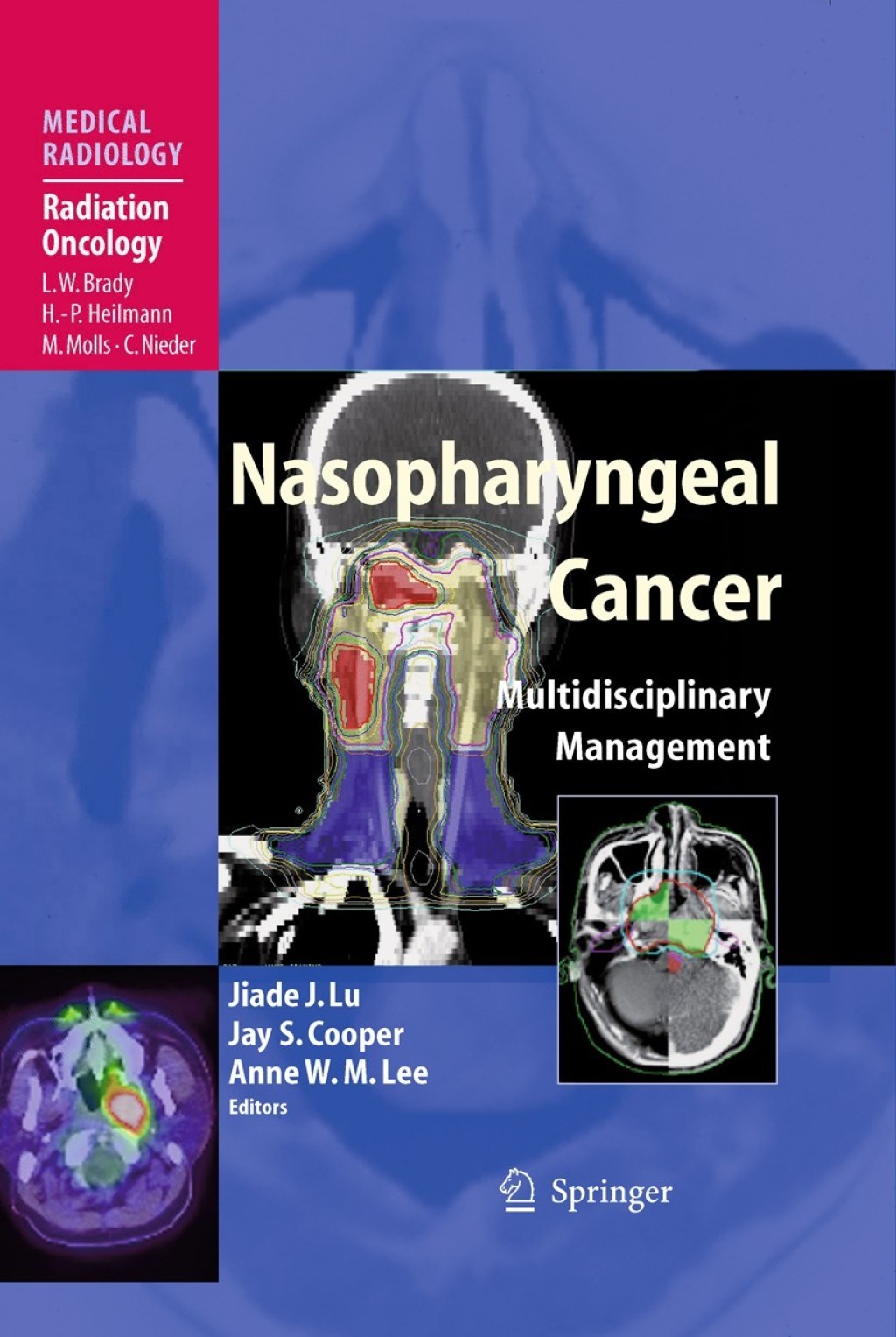 Nasopharyngeal Cancer Multidisciplinary Management 1st Edition