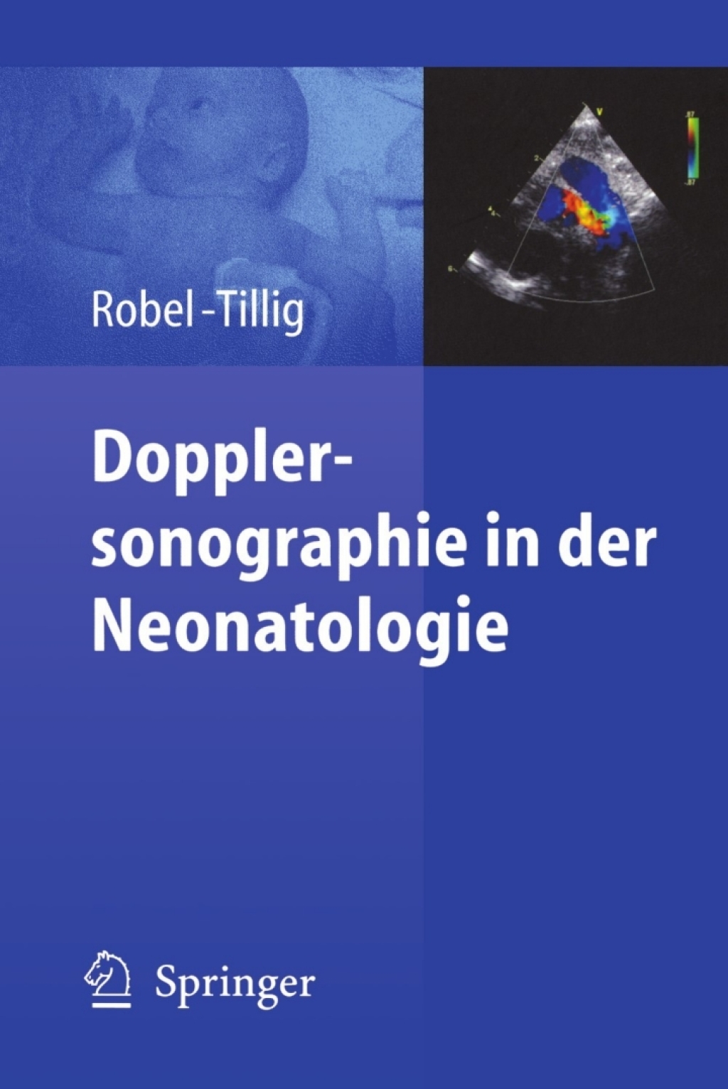 Dopplersonographie in der Neonatologie 