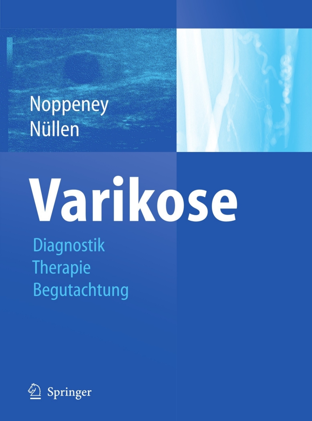 Varikose Diagnostik - Therapie - Begutachtung 