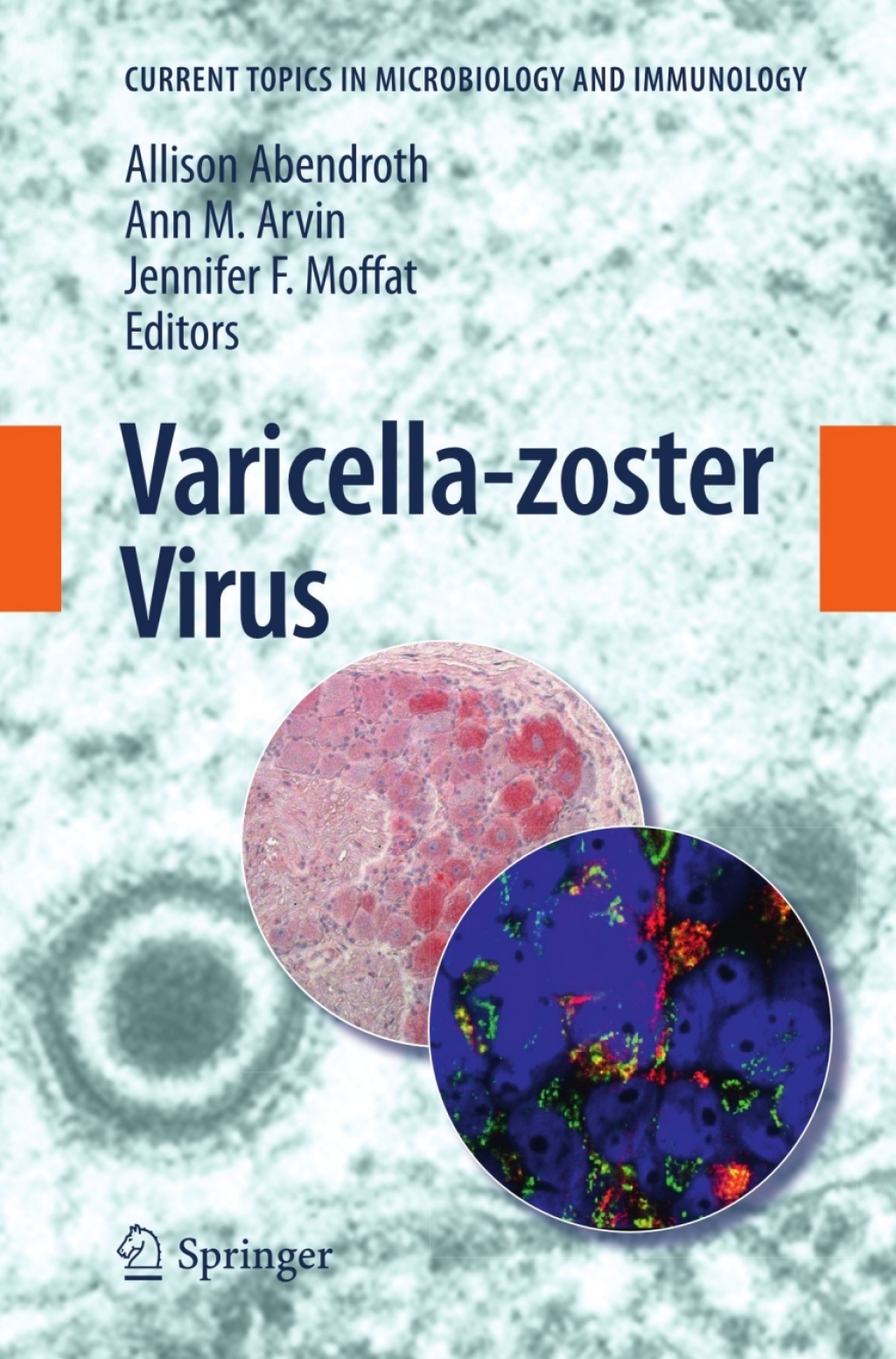 Varicella-zoster Virus 