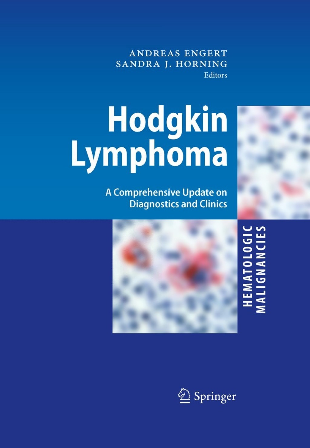 Hodgkin Lymphoma A Comprehensive Update on Diagnostics and Clinics 1st Edition